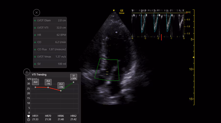 1---r2-vti-trending_900x500