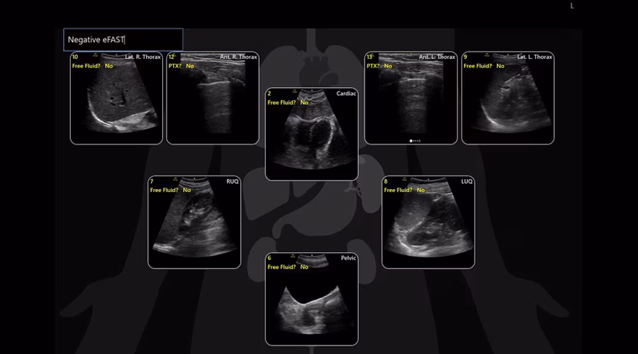 9---efast-diagram_900x500 (1)
