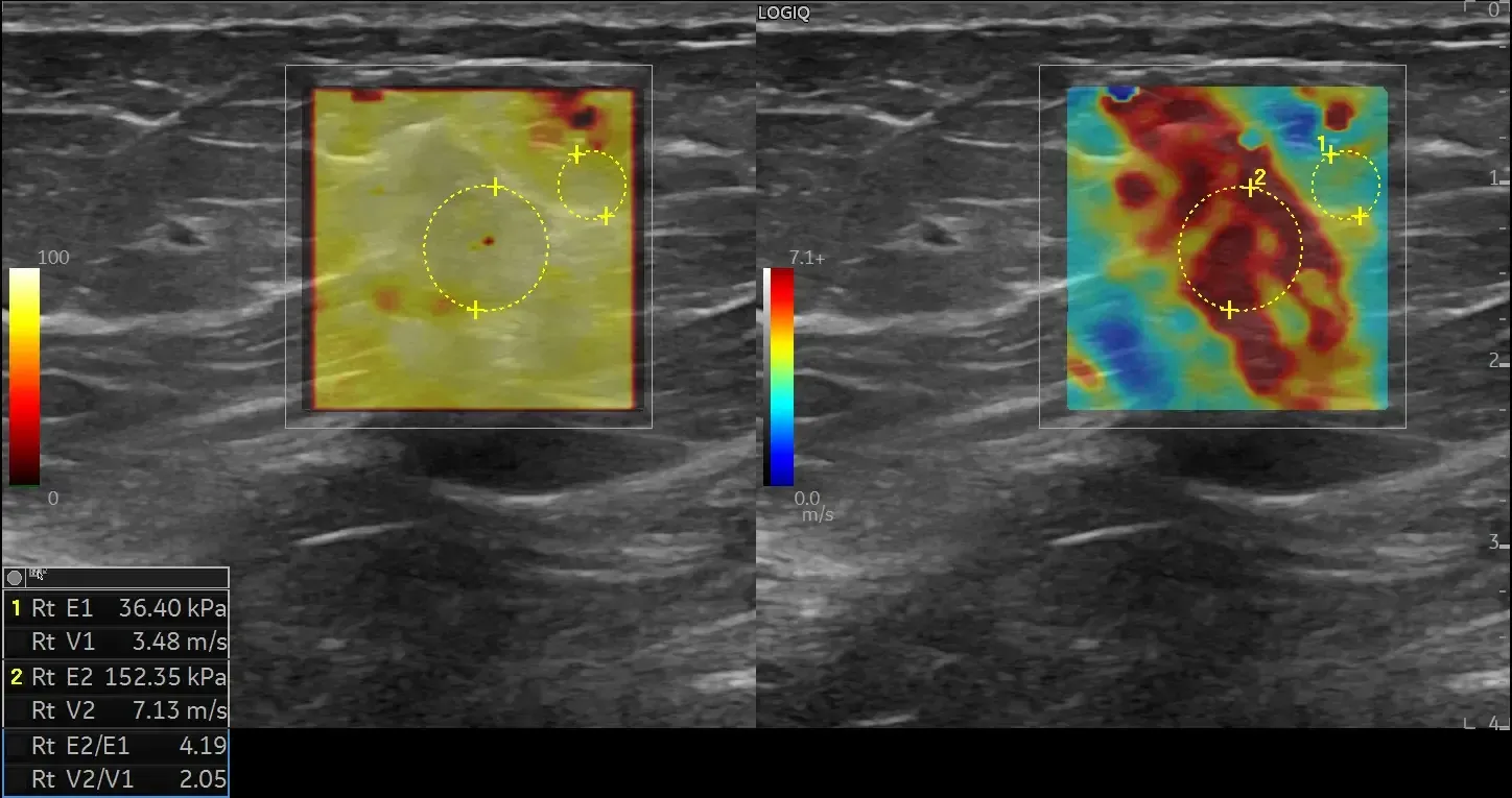 breast-p15-BRV73jNi