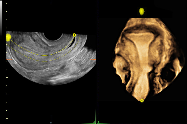 voluson-p8-sales-sheet
