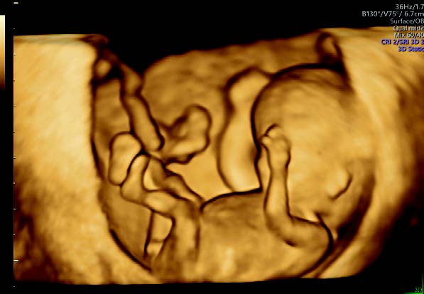 voluson-p8-sales-sheet3