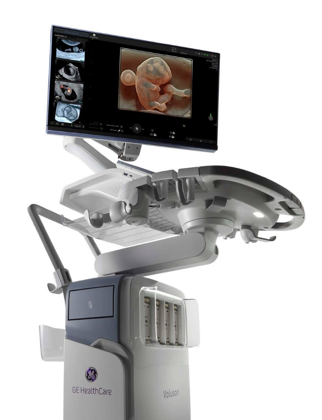 voluson signature 20_1