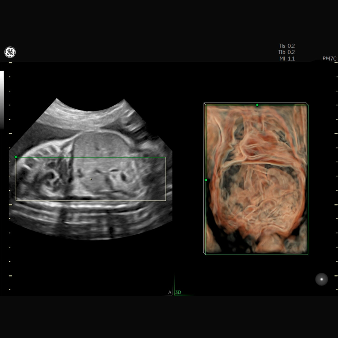 VolusonEXP20-Architecture