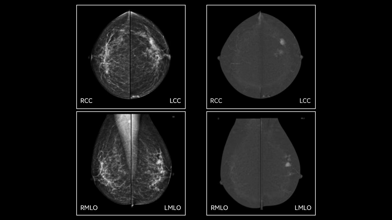 Plantilla - GALERÍA DE PRODUCTOS
