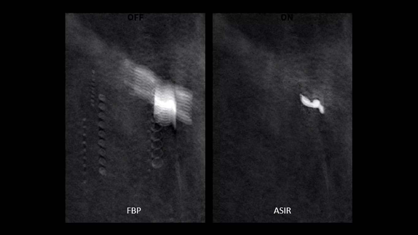 Senographe Pristina plantilla